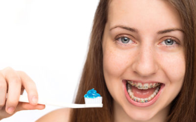 Brushing with Braces: How to Keep a Clean Mouth