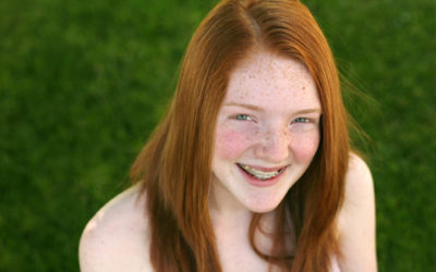 Helpful Hints for Dealing with Braces Pain