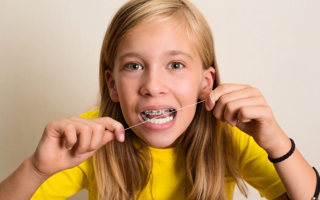How to Floss with Braces: A Guide for Kids
