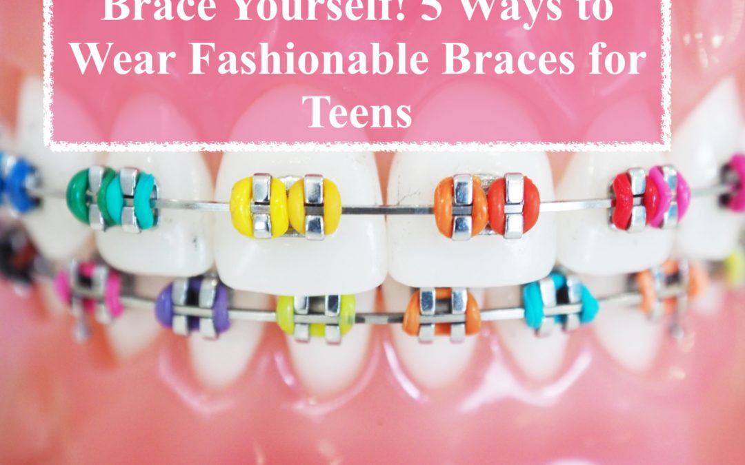 Brace Yourself! 5 Ways to Wear Fashionable Braces for Teens