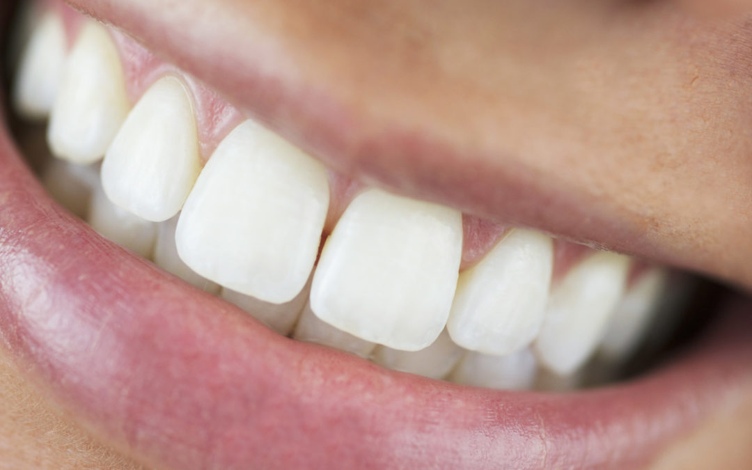 Overbite vs Underbite: the Similarities and Differences