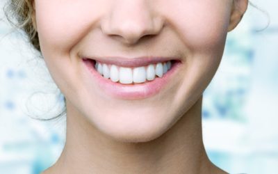 How Long Do Braces Take to Straighten Teeth?