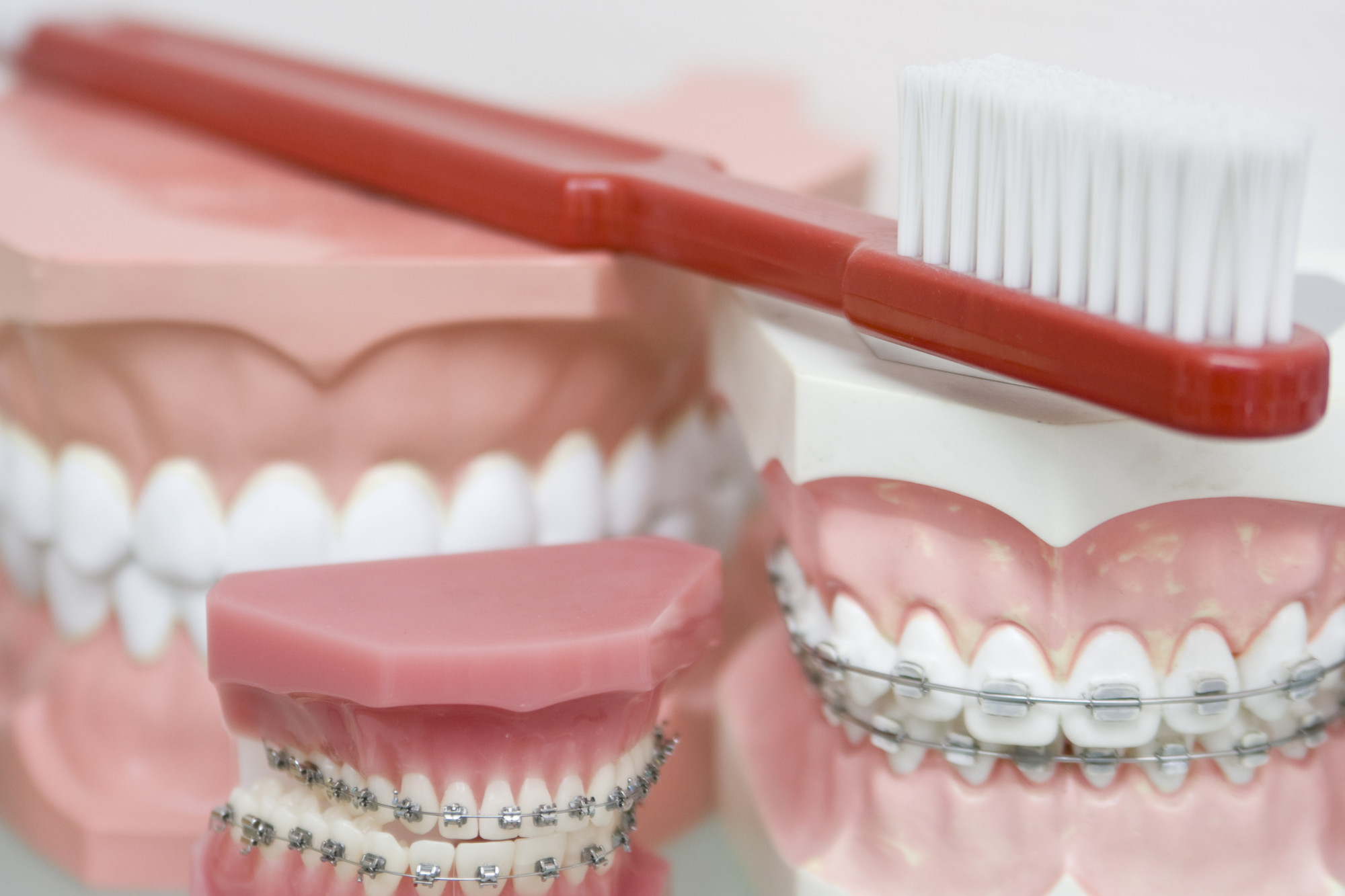 Straight Talk from a Cleveland Orthodontist About Adult Braces