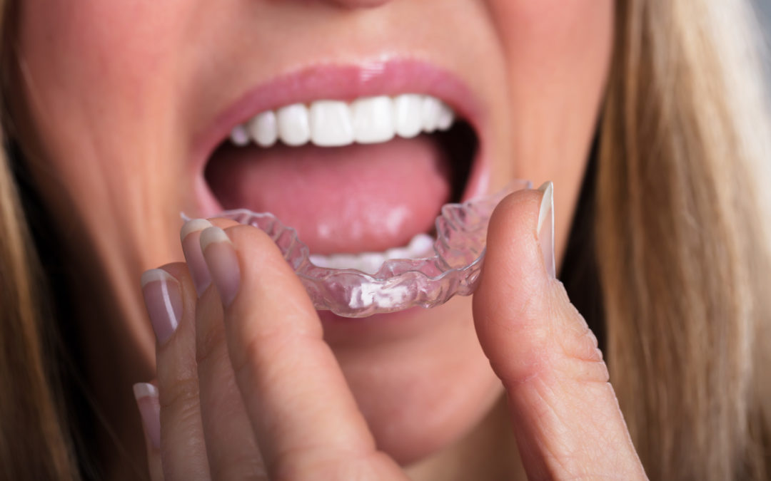 Clear Correct Braces or Invisalign Treatment: What Is the Difference?