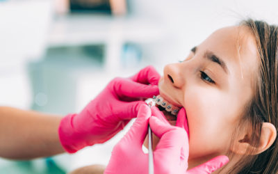 7 Ways a Cleveland Orthodontist Can Contribute to a Healthy Smile
